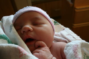 怀孕妊娠合并新生儿Fabry病怎么酶替代？
